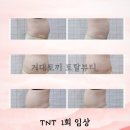 장림초(이삭토스트) | 거대토끼토탈뷰티 :: 머슬테라피 TNT, 30분 자기장 근육운동 💪🏻, 1회차 전/후 비교사진有