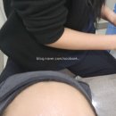 안 아픈 스킨부스터 라디쥬 2주 후기 / 영등포역 피부과 피부관리