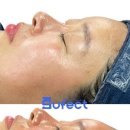 레티나메디칼 이미지