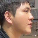 레이저보이 | 전주레이저제모 젠틀맥스프로플러스로 남자 수염 레이저 제모 솔직후기