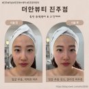 예손뷰티샵 | 진주 주약동 윤곽관리, "더안뷰티 진주점" 동안얼굴 윤곽 &amp; 스킨케어 솔직한 후기