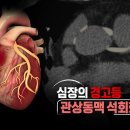 [924회] 생로병사의 비밀/[심장의 경고등, 관상동맥 석회화 지수] 한순간도 쉬지 않고 움직이는 우리 몸의 엔진, 심장... 이미지