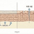 온산의원 | 유황비누 | 의사로써 권하지 않는 이유와 고민별 대안