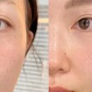 미녀손톱 이미지