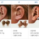 드림보청기 이미지