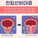 환절기 기온차에 취약한 ‘이 병’…중년 이후 남성 주의 이미지