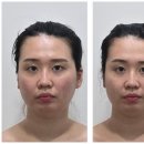 예쁜인스킨케어 | 부산대 뷰티인스킨앤바디에서 경험한 작은얼굴 윤곽관리 솔직후기