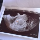 최세미산부인과의원 이미지