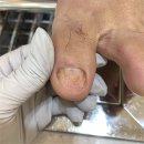미엘네일닥터아이티엔범계지점