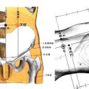 천추혈(天枢穴)은 자궁근류(子宫筋瘤 Histeromyoma) 치료혈 이미지