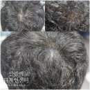 대호카프라자 | 노원 두피 SMP 잘하는 곳 - &#39;인블랙 디자인센터&#39; 후기