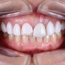 세라치과기공소 이미지