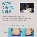 연세라마르의원 네이버블로그