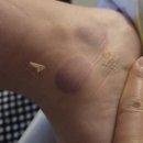 제일한의원 | 미남역 미남제일한의원 : 사우나피셜 1위 추나치료 방문후기