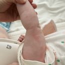 뉴이진소아청소년과의원 | 천안 뉴이진소아청소년과의원 아기 피부염 치료 후기