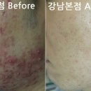 리유한의원 네이버블로그