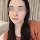 위드프러스타워 | 부천 피부관리실 미네에스테틱에서 여드름관리 받고 왔어요