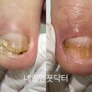 네일앤풋닥터 네이버블로그