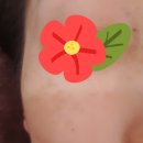 레이저 토닝 받은 후기 경산 리뉴한의원