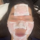 수원-1082 | 수원피부관리 더 세레니티에스테틱 자극없는 스킨플래닝 후기