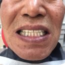 참진치과기공소 이미지