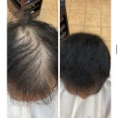 포항온누리 음악교습소 | 포항에서 온 희망의 빛: 남자탈모, 토탈 탈모 교정 성형펌으로 정면 돌파! 부산사상르네시떼6층미용실