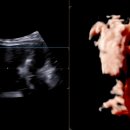 동구 보건소 앞 | [임신15~16주차] 증상, 신경관결손검사, 독감무료접종, 광주동구보건소 임산부 철분제수령
