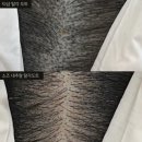수정샵송내동 | 부천두피문신 잘하는 곳 찾고 계신가요? 가격보다 중요한 선택 기준