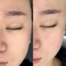 탄방메디칼 | 대전 스킨플래닝 엘리시아브로우 피지 각질 톤업 효과까지