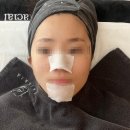 케어메드 | [스컬트라] 스컬트라 1차 내돈내산 관리 후기(SPM, 바쿠메드, 더미오케어)