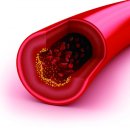 프레비스 이미지