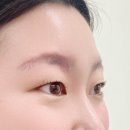 도치도트 탈모 두피케어 속눈썹
