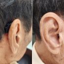 스타키보청기 포항점 이미지