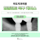 청담치과기공소 이미지