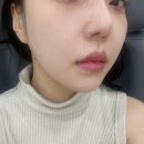 더프라이드성형외과의원 네이버블로그