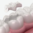 연세든든치과 이미지