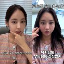 알리다랩 | 래퍼 육지담, 성형외과 상담실장으로 새 출발! 리프팅 시술 체험 공개, 그 놀라운 변화는?