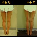 후메디앙스 이미지