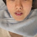 강남브이에스(VS)라인의원 | 연예인들도 받는 티타늄리프팅 직접 받아봤어요 (신분당선역 강남역 올피채의원 시술 후기)