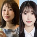 이세영헤어 | ‘1억 성형’ 이세영, 확 달라진 비주얼… 7월 겹경사까지 전했다