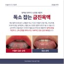 금진한의원 네이버블로그