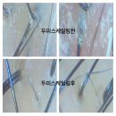 송 헤어샵 (song s hair ) | 아로마두피스파. 두피스케일링. 문제성두피케어전문샵. 헤어바이송