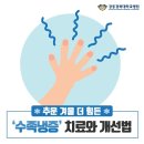 추운 겨울 더 힘든 ‘수족냉증’ 치료와 개선법 이미지