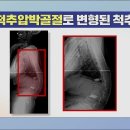 골다공증이여 안녕 뼈 미인 되는 법 이미지