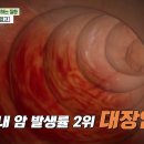 [닥터의 경고, 대장암] 국내 암 발생률 2위 대장암! 생존율도 높고 사망률도 높다? 조기에 발견하면 생존율 90% 하지만... 이미지