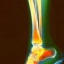 오리궁뎅이 이미지