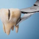 메가플란트치과의원 이미지