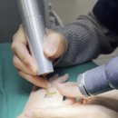 클린타투의원 이미지