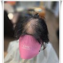 동경헤어 - 해운대구 윗반송로51번길 221 | 부산가발 동경헤어 여성 정수리 가르마 부분 가발 후기