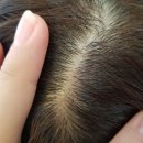 쎄뚜헤어라인 | 배곧 앙포레 헤드스파추천 리안헤어오렌지시화점 정왕동미용실_두피관리방법